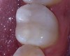 Konzervativna stomatologija 6